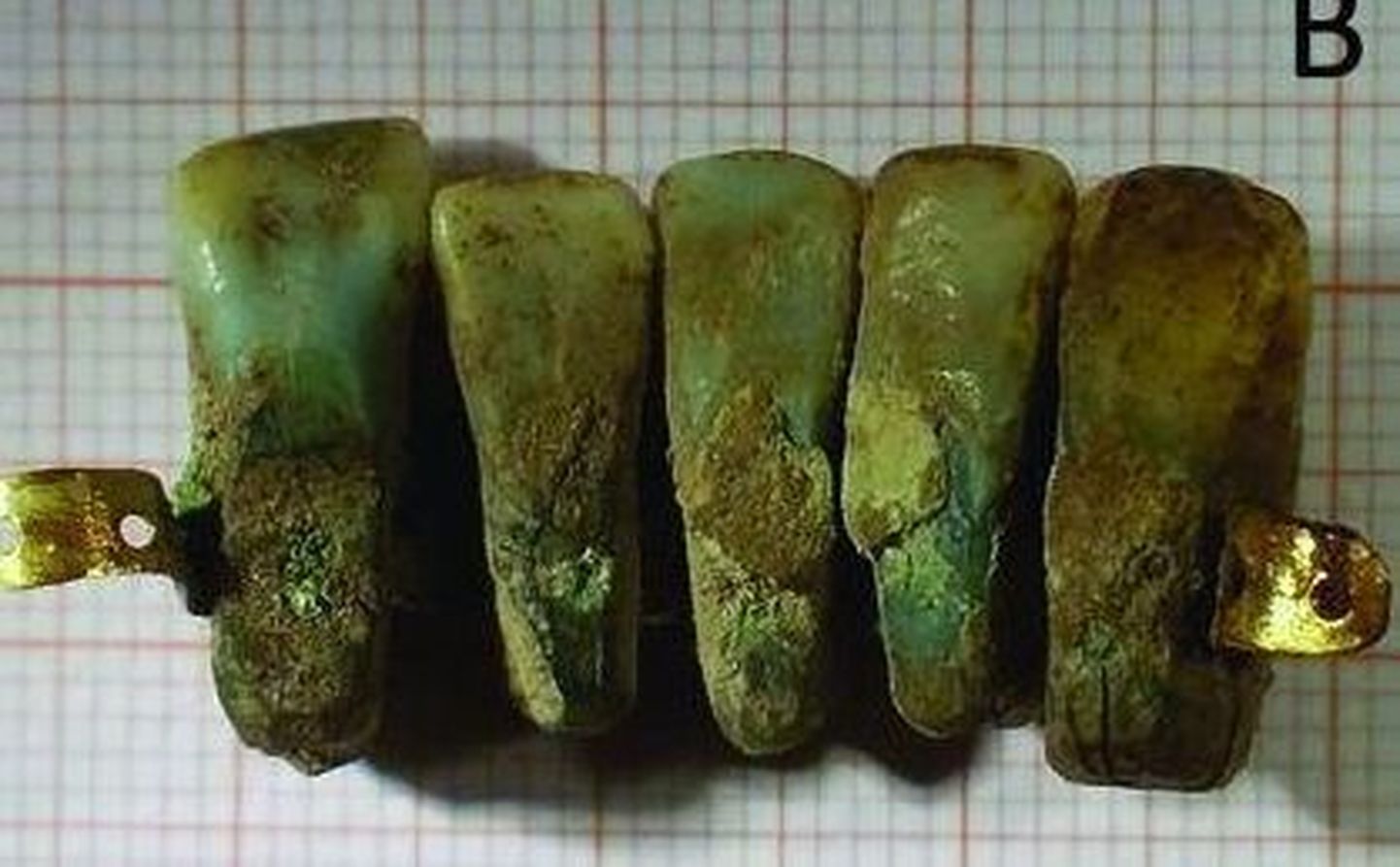 400 aasta vanune hambaprotees