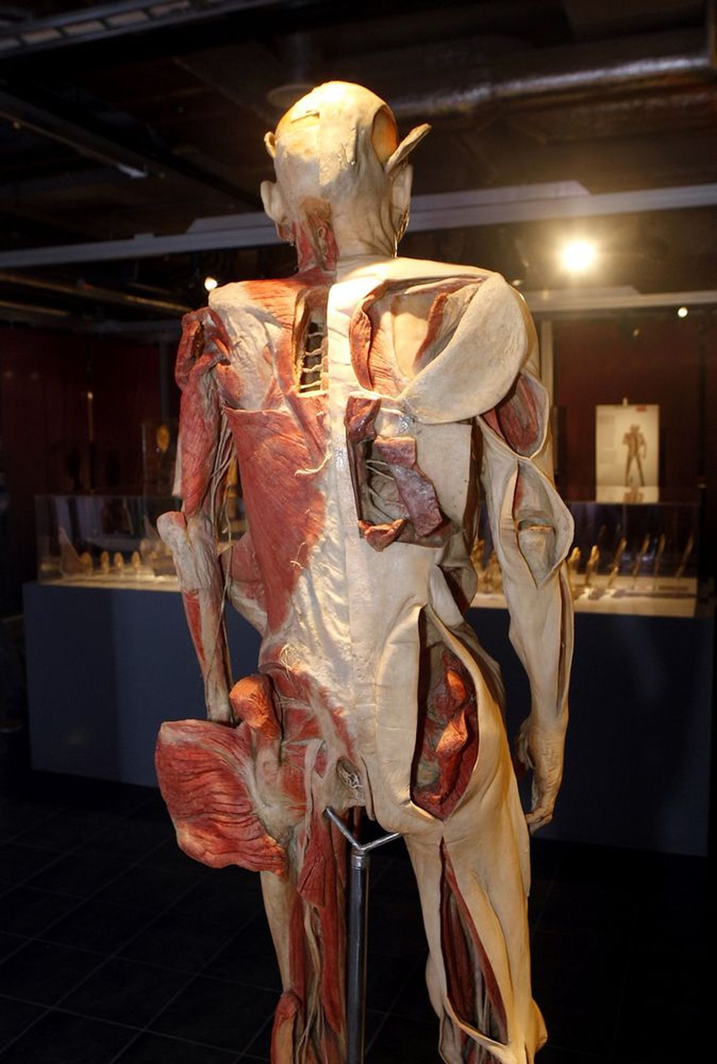 Näitusel «Bodies revealed» paljastatakse inimkeha sisemus - 
Solarise näitusesaalis on esil maailma menukaim rändnäitus, kus saab näha palsameeritud inimkehasid, neist välja võetud organeid, luustikke ja isegi surnud looteid.