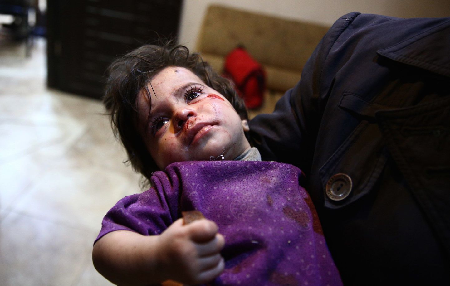 VÄidetavalt Süüria režiimi õhurünnakus viga saanud Süüria laps mässuliste käes olevas Doumas.