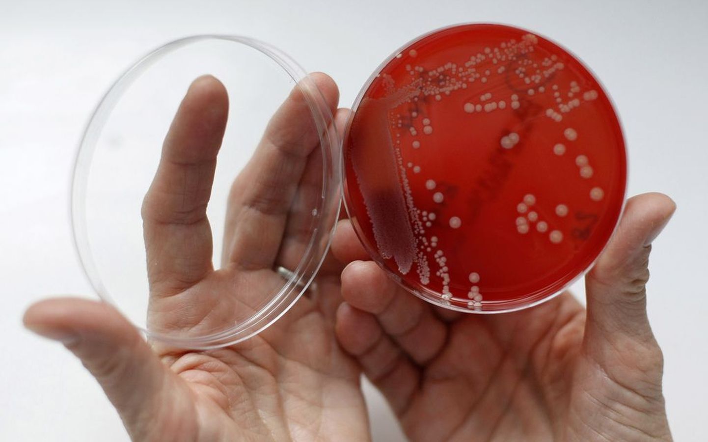 Ravimitele resistentsed MRSA bakterid Petri tassil.