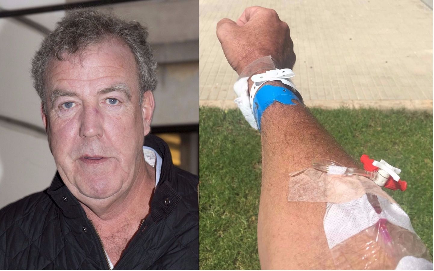 Jeremy Clarksoni puhkus lõppes haiglas