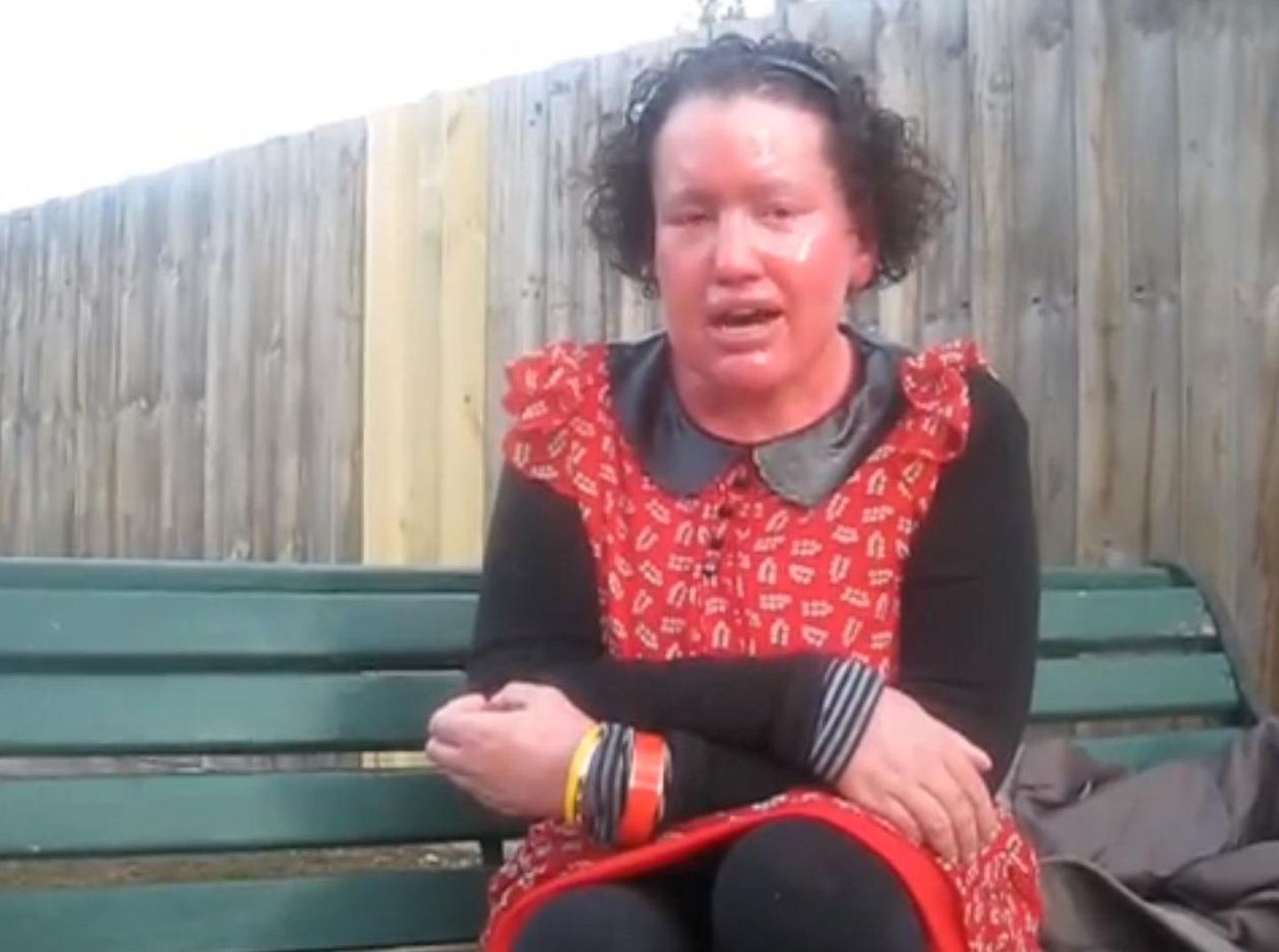 Nahapunetuse all kannatav naine astus internetikiusajatele vastu