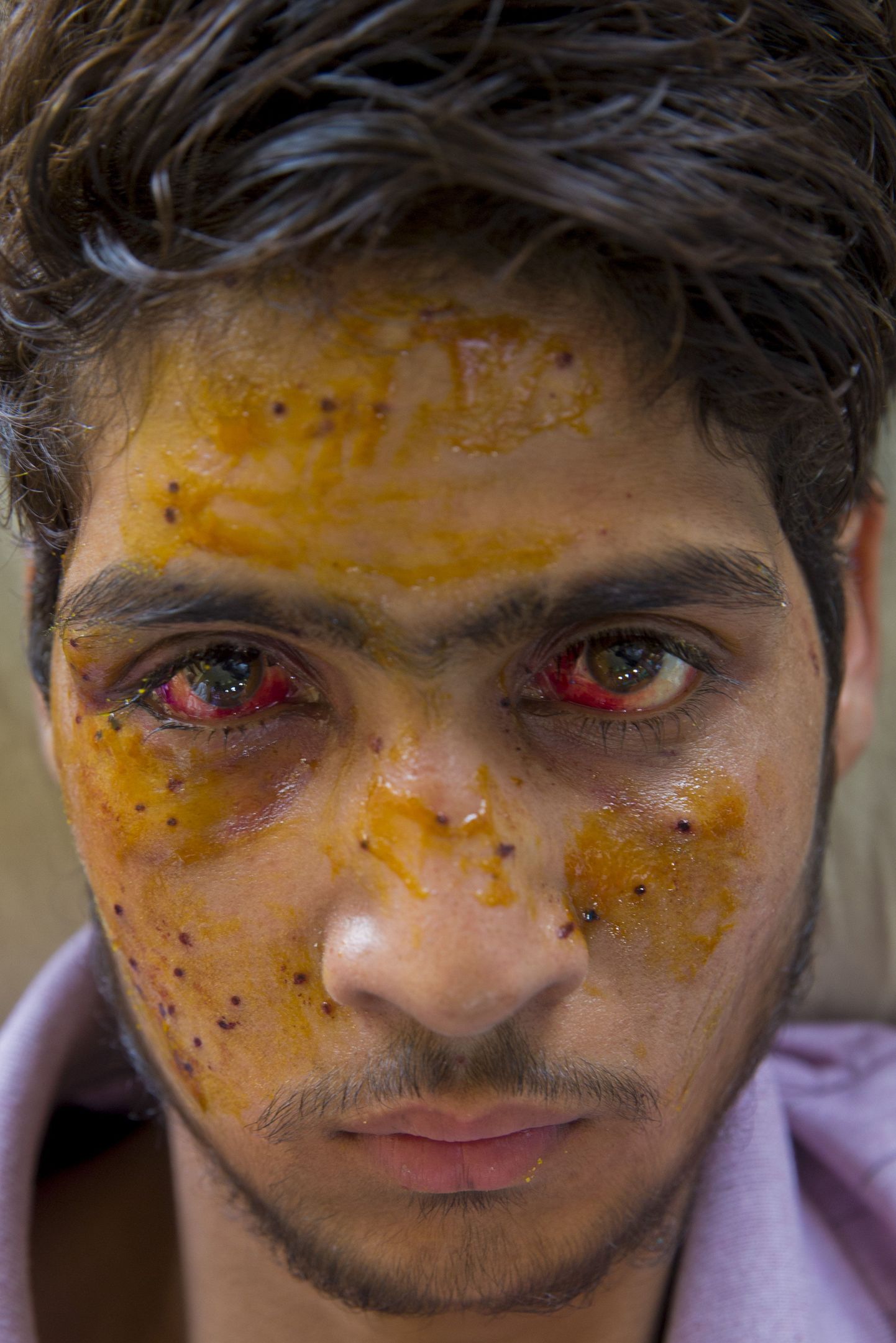 Üks India vastastel meeleavaldustesl vigastada saaanutest