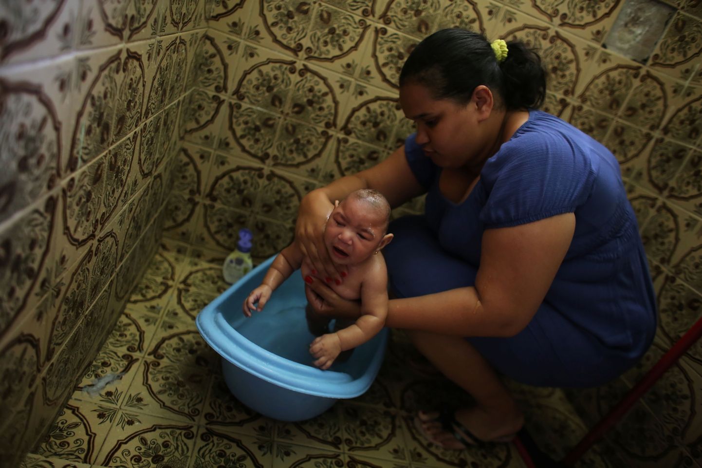 Mikrotsefaaliaga sündinud laps Brasiilias