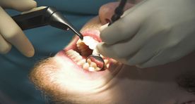 What will the year 2017 bring us? From broken teeth to fishing