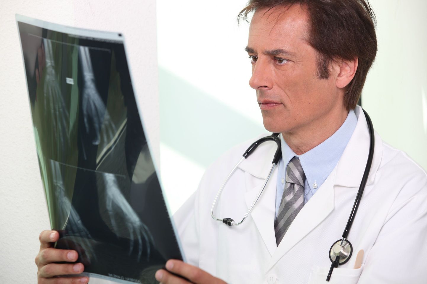 Luumurdude või -mõrade välja selgitamiseks uurib doktor röntgenuuringu käigus tehtud röntgenipilti.