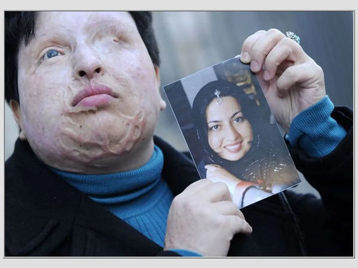 Ameneh Bahram hoidmas käes fotot iseendast enne happerünnakut