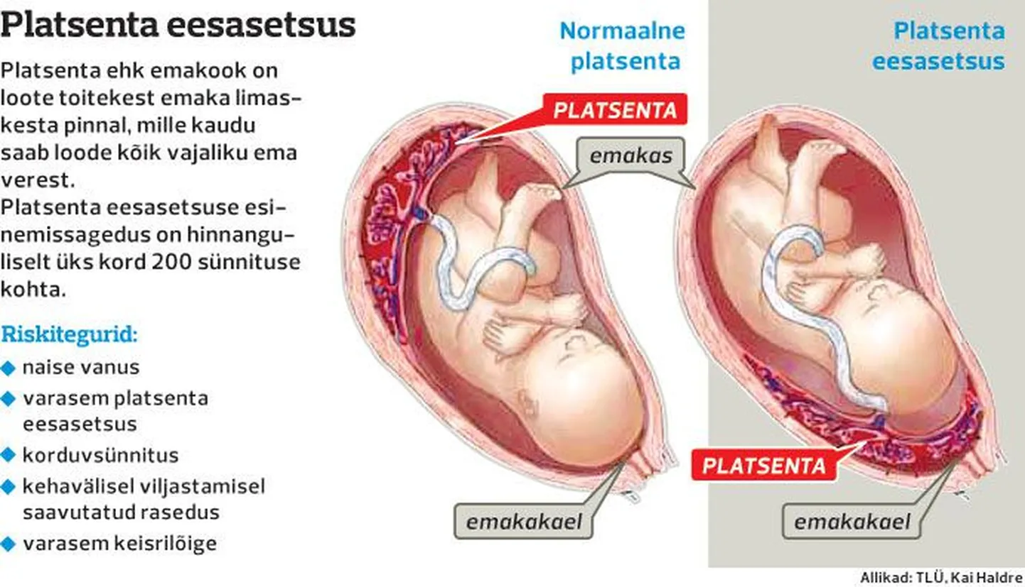 Platsenta eesasetsus.