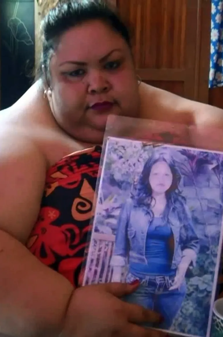 37-aastane indoneeslanna Titi Wati kaalub 350 kilogrammi. Foto kohaselt oli ta varem normaalkaalus