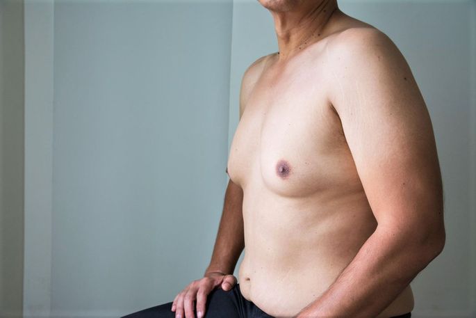 5 причин, по которым у мужчин растет грудь | Саморазвитие и личностный рост | Дзен