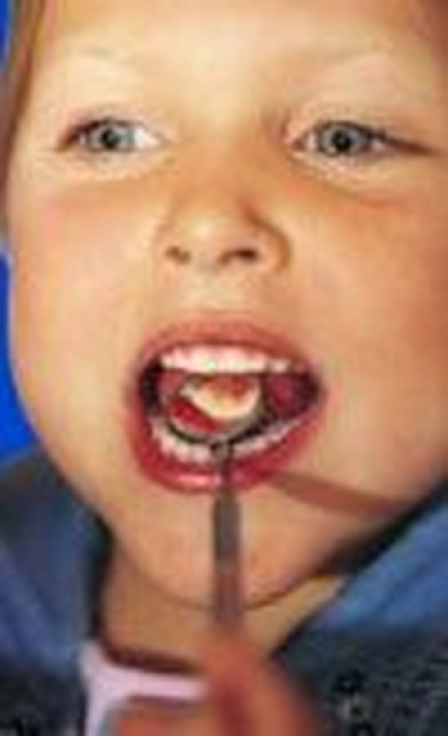 Laps hambaarsti juures. Foto on illustreeriv