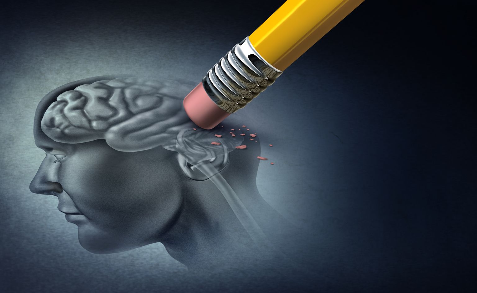 Alzheimeri tõbi on neuroloogiline häire, mille puhul aju aeglaselt taandareneb.