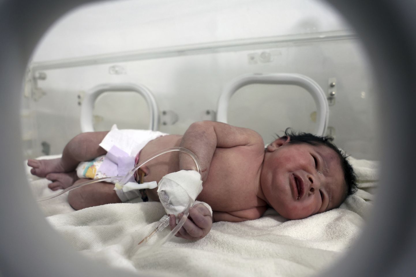 Meitenīte Aija, kas piedzima zem gruvešiem pēc zemestrīces Sīrijā.