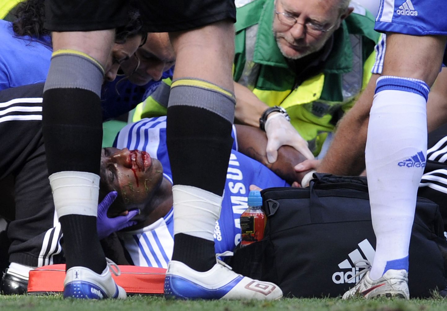Didier Drogba sai augusti lõpus mängus Norwichi vastu raskelt vigastada.