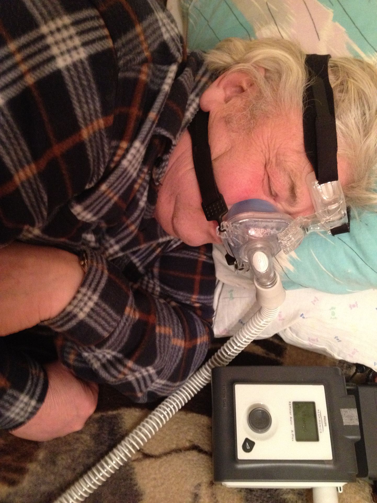 71-aastane Vootele on nüüd juba üle kuu aja kasutanud CPAP-raviseadet ning tema öised hingamiskatkestused on vähenenud.