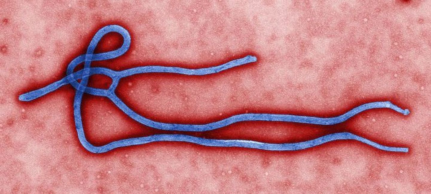 Вирус Эбола под электронным микроскопом.