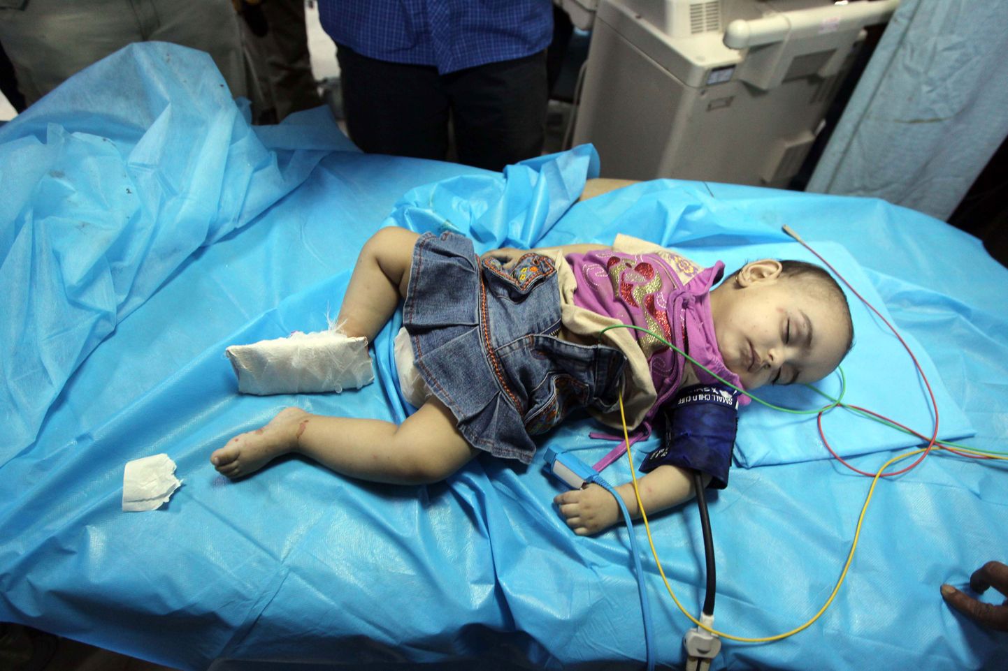 Vigastada saanud seitsmekuune tüdruk Tripoli haiglas