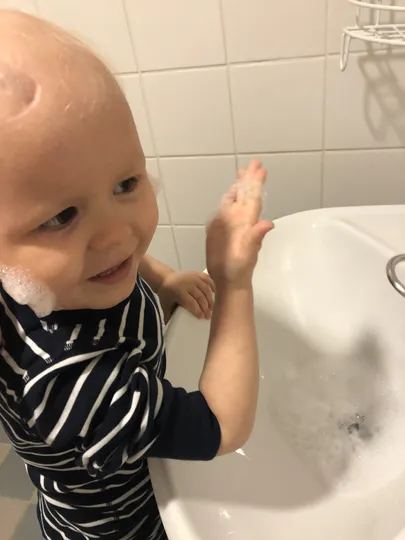 Keemiaraviga sai alustada, kui haav paranenud.