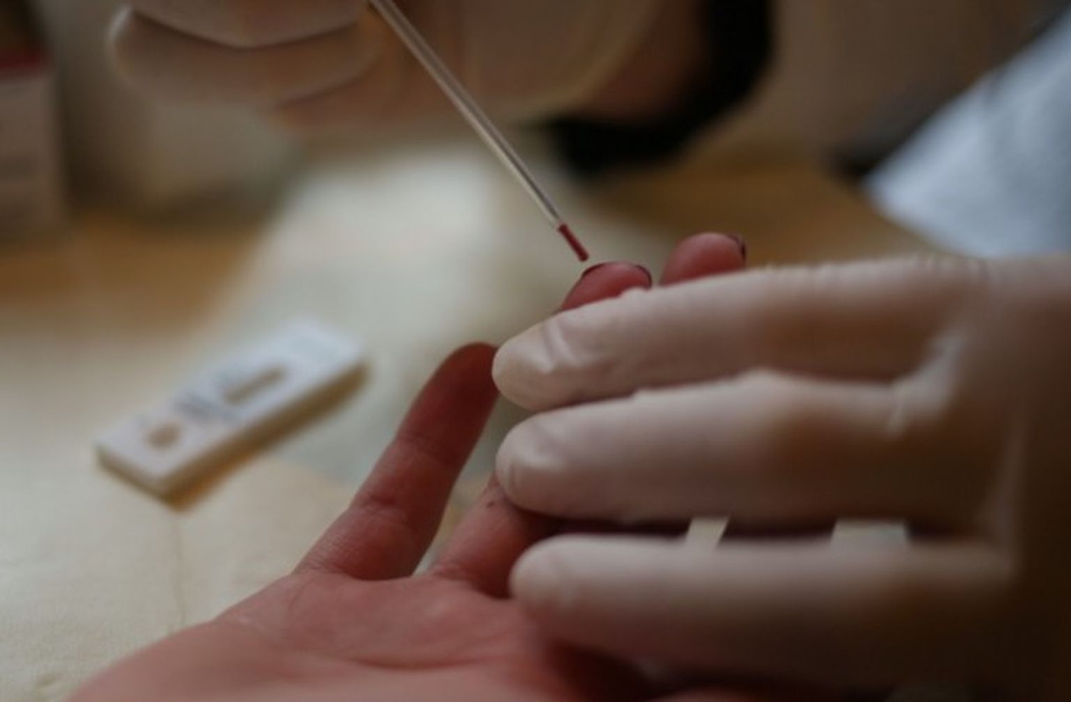 HIV eksprestests; ilustratīvs attēls.