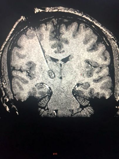 Röntgenpilt mehe ajust.
