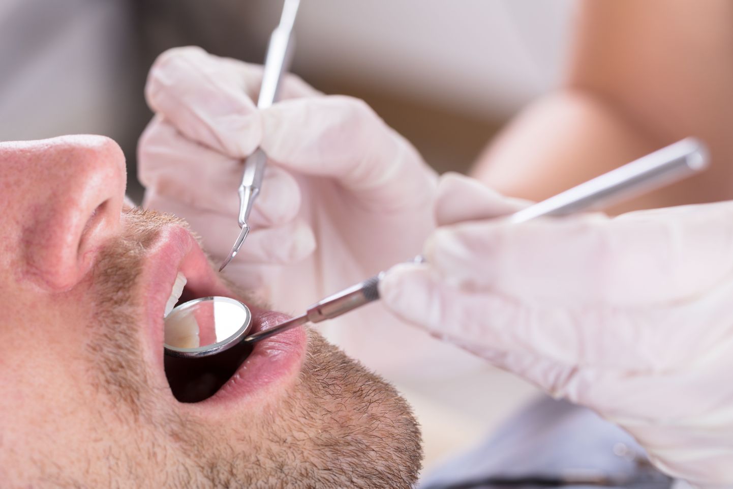 Täiskasvanute hambaravihüvitise kasutamisel peab patsient tasuma vähemalt 50 protsenti arvest.