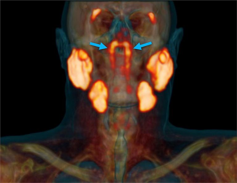 Vastleitud süljenäärmed paiknevad ninaneelu taga koljupõhimiku all.