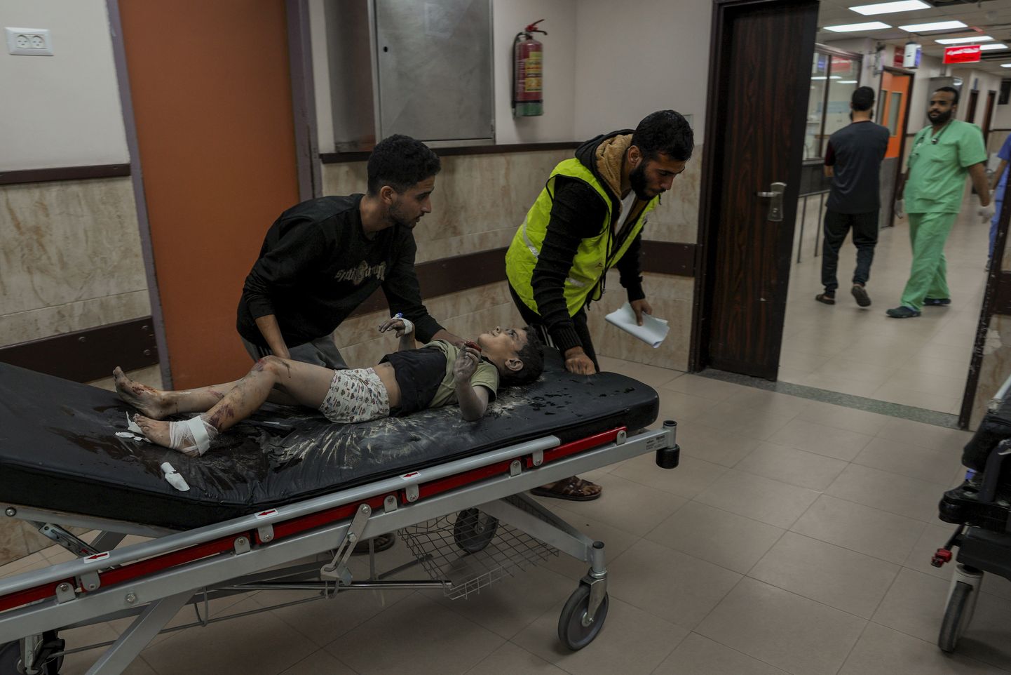 Палестинский ребенок, раненый во время авиаудара Израиля.