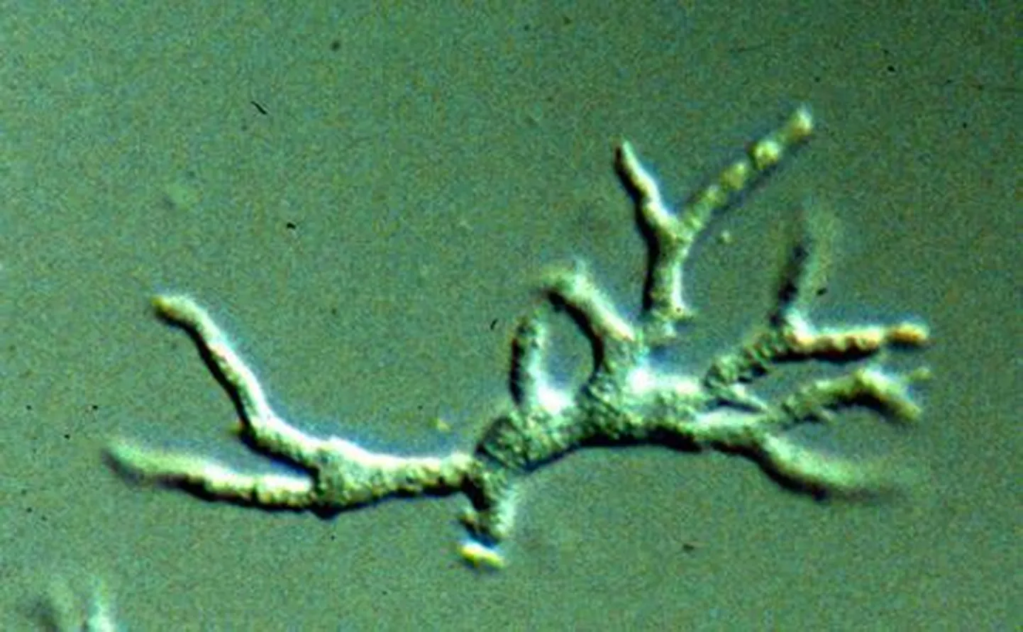 Balamuthia mandrillaris amööb