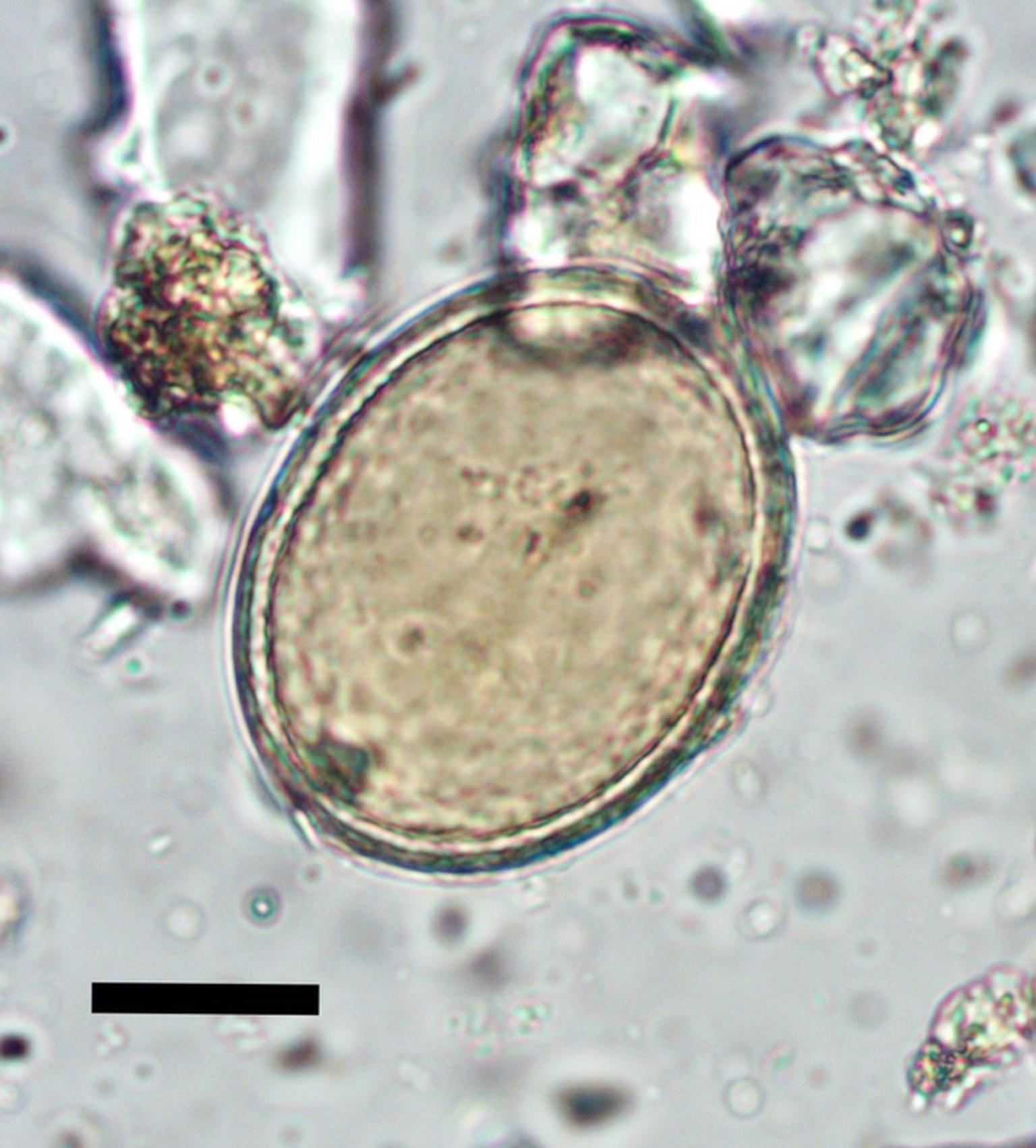 Mikroskoobipilt solkme munast, mis leitud Cambridge munga keskajast pärinevast matmispaigast.