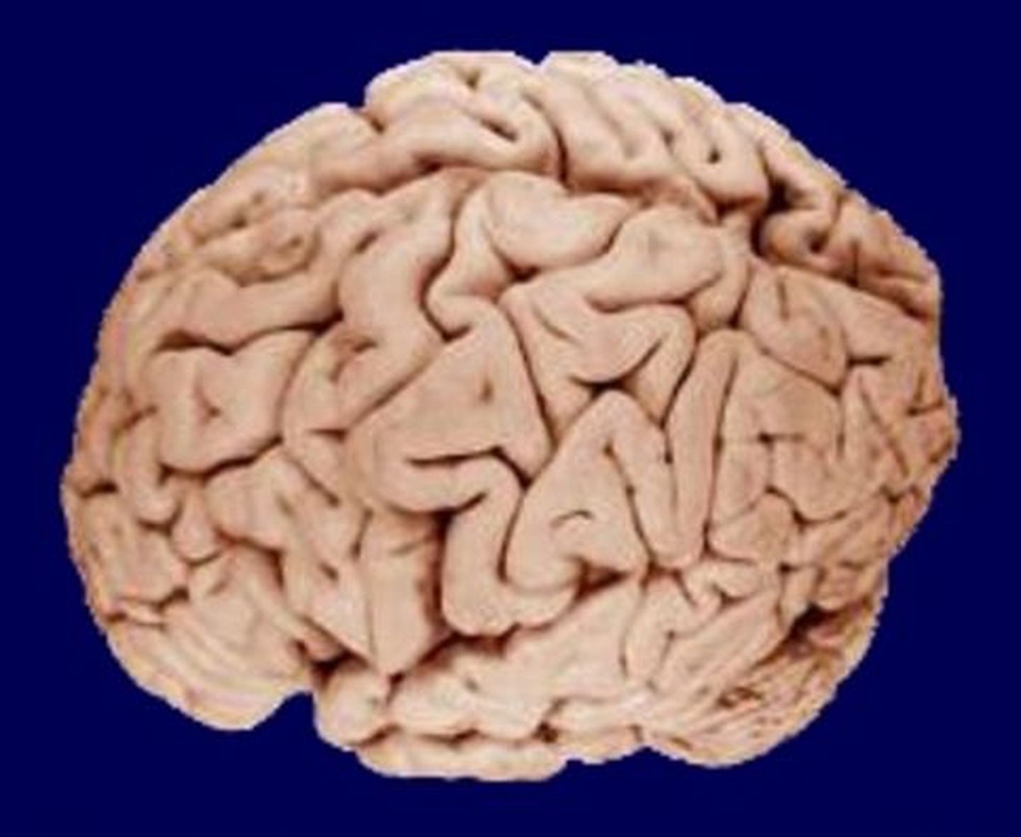 Мозг человека.
