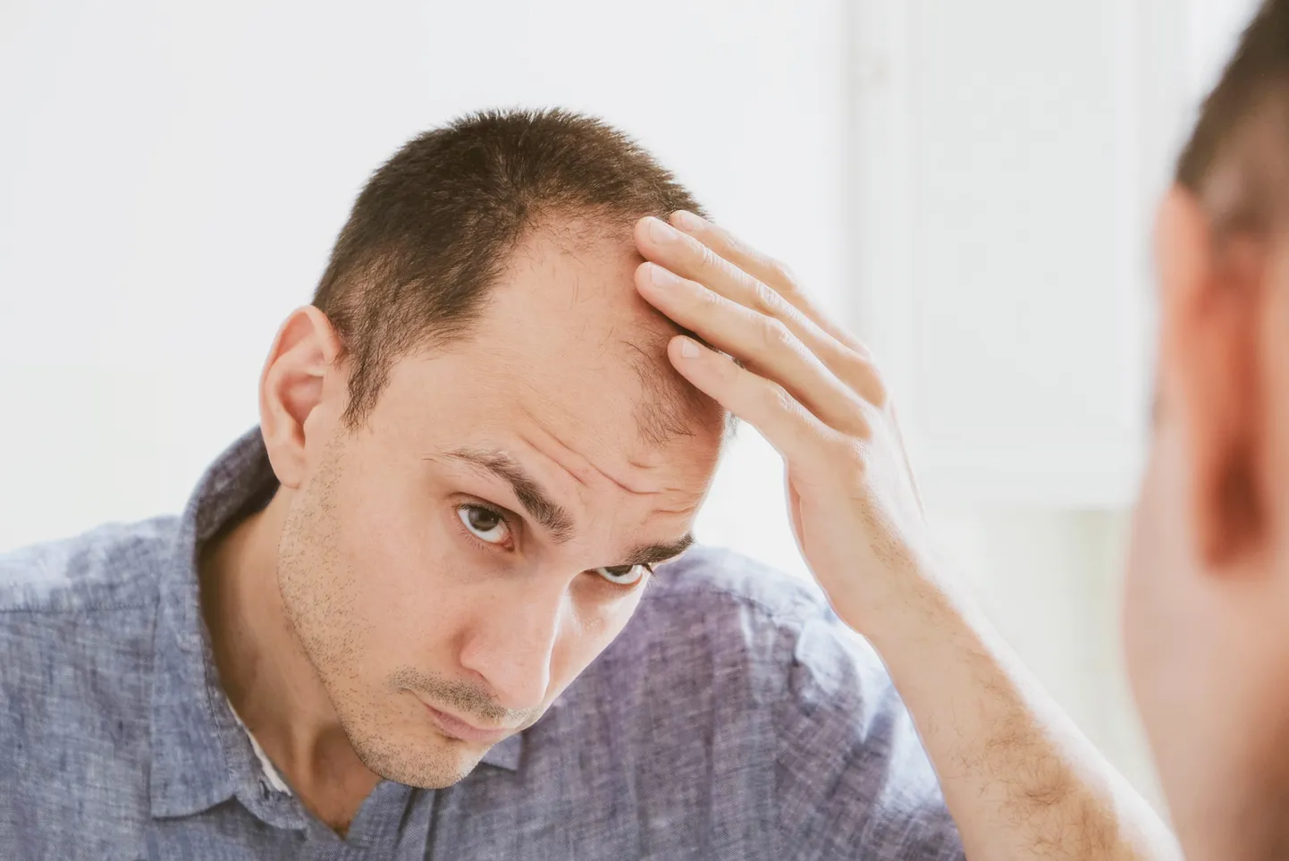 Alopeetsia