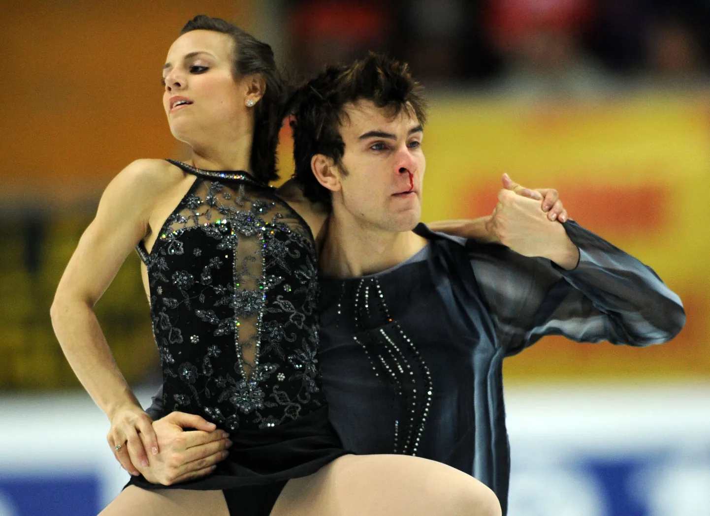 Eric Radford sai lühikava ajal oma partnerilt Meagan Duhamelilt kogemata küünarnukiga näkku ja murdis ninaluu.