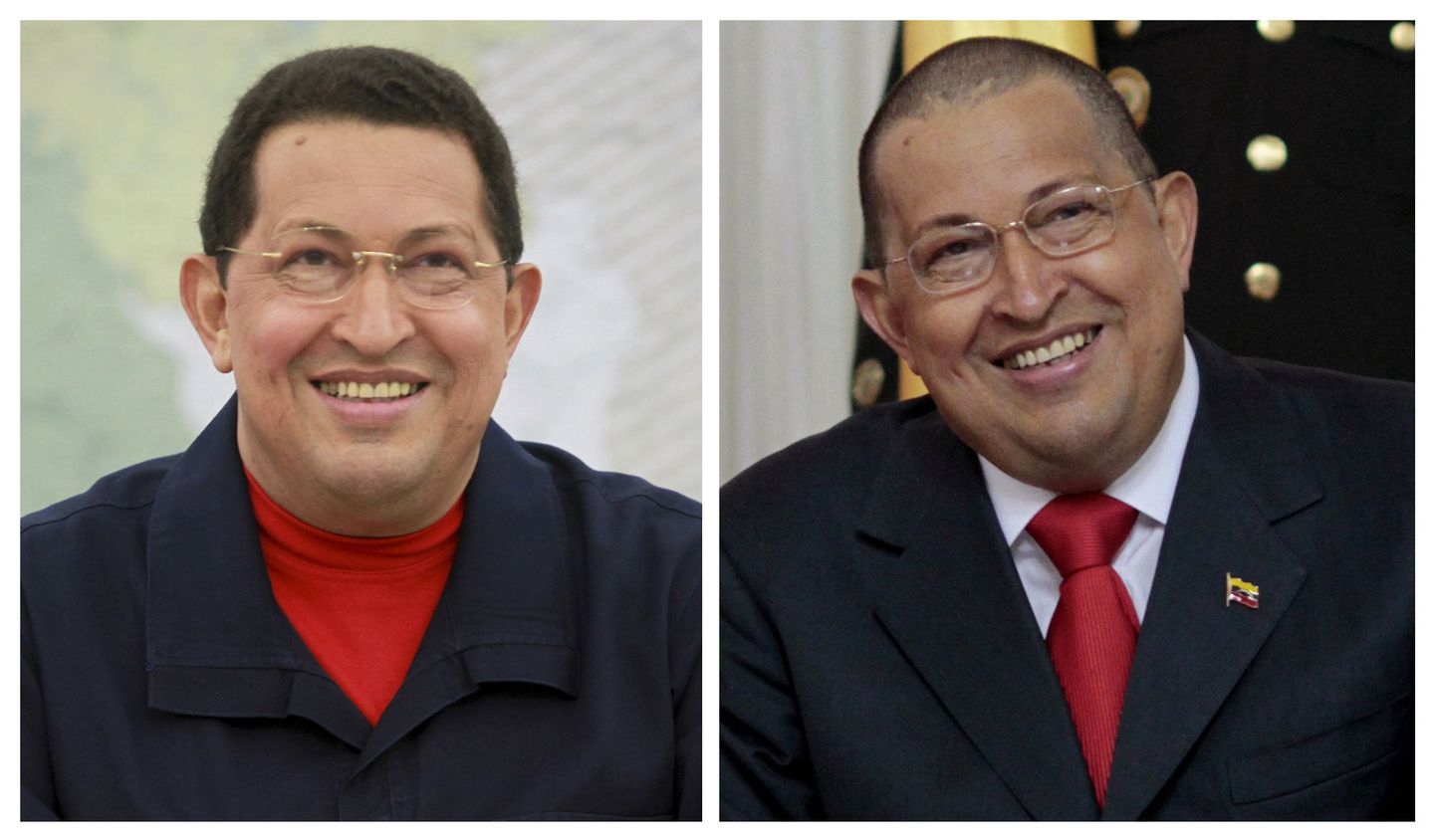 Venezuela president Hugo Chávez enne ja pärast kemoteraapia esimese kuuri läbimist.
