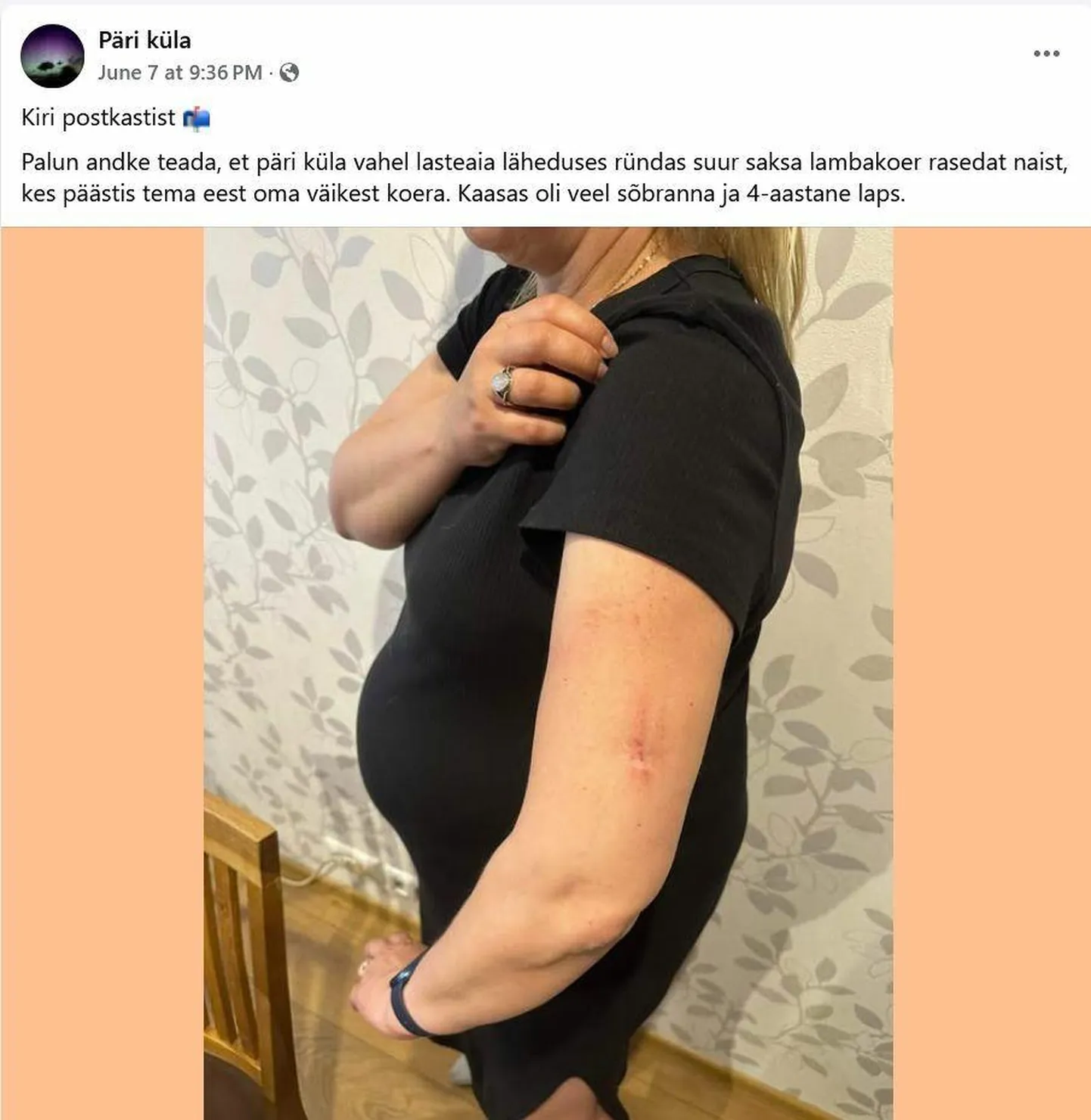 Päril koerarünnakus viga saanud naine andis juhtunust teada sotsiaalmeedia grupis ja ka häirekeskusele.