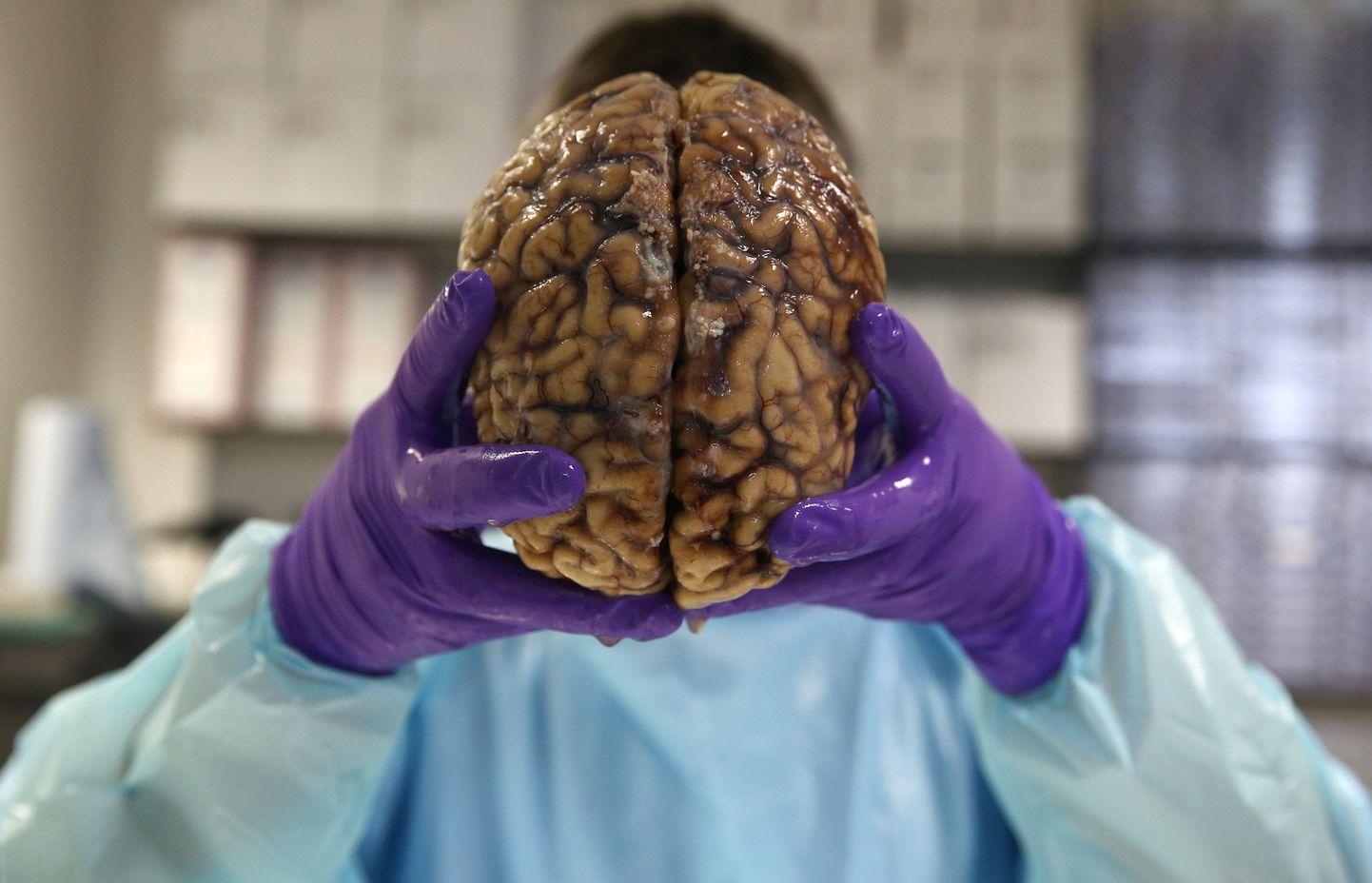 Cilvēka smadzenes.