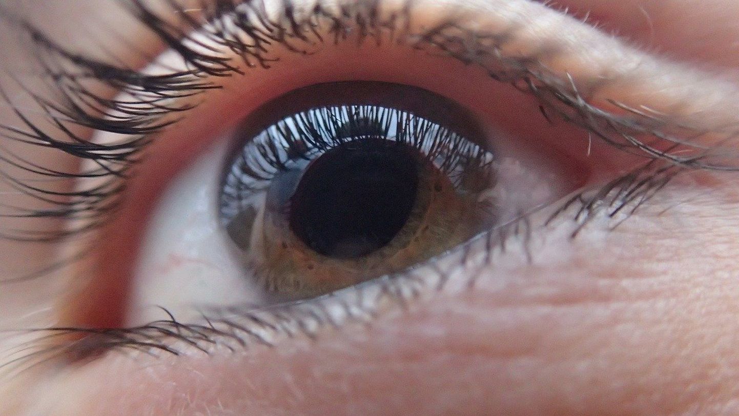 Cilvēka acs.