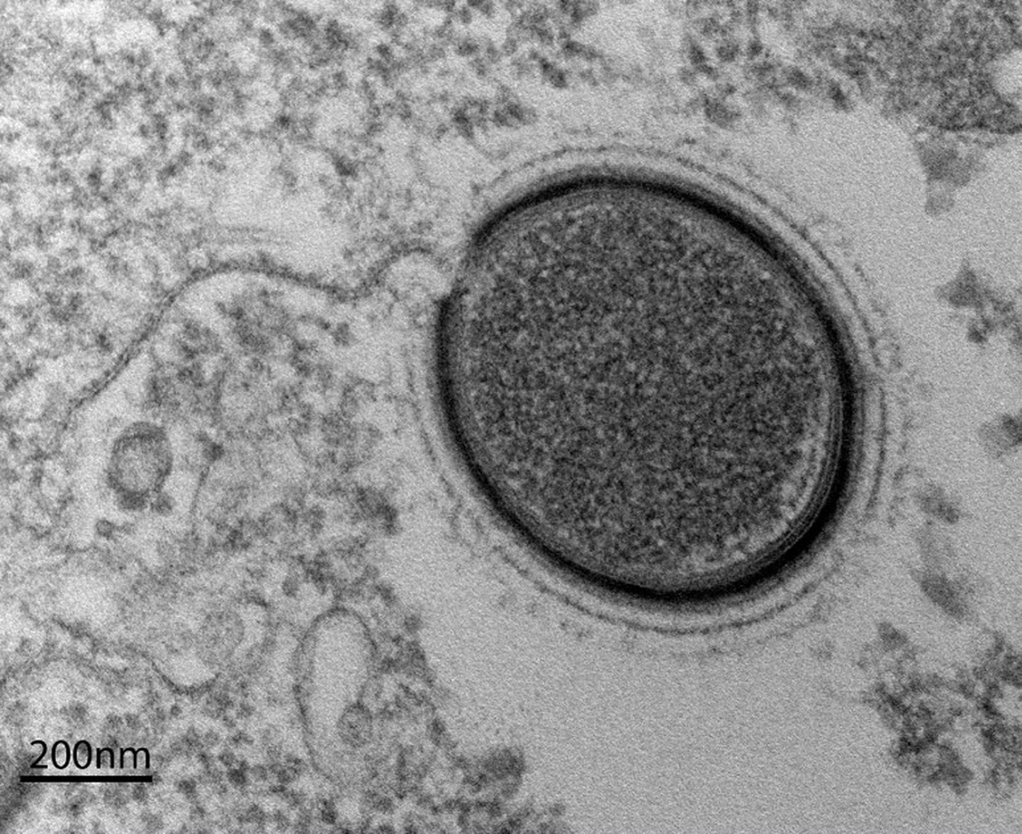 Sügavalt Siberi igikeltsast avastasid 2015. aastal Aix-Marseille ülikooli meditsiiniteadlased viiruse Mollivirus sibericum.