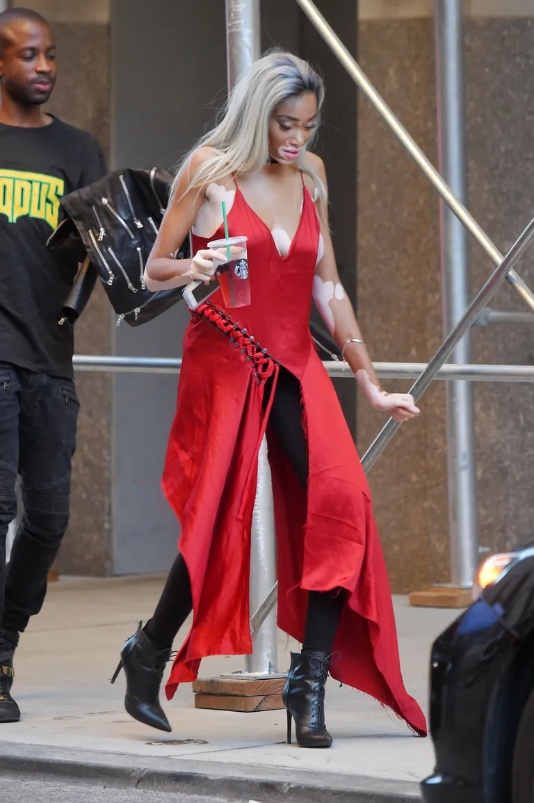 MANHATTAN, NY - SEPTEMBER 07, 2016: Winnie Harlow in red sits on a scaffolding in the Flatiron District on SEPTEMBER 07, 2016 in New York(Photo By Josiah Kamau / BuzzFoto.com)Buzz Foto LLC httpwww.buzzfoto.com 1112 Montana Ave suite 80 Santa Monica CA 90403 1 310 980 8822 1 310 691 3888 Local Caption *** Winnie Harlow