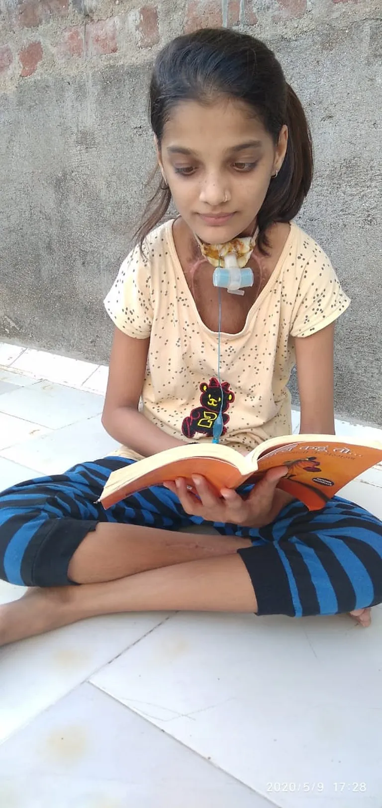 Surbhi Ben pärast operatsiooni.
