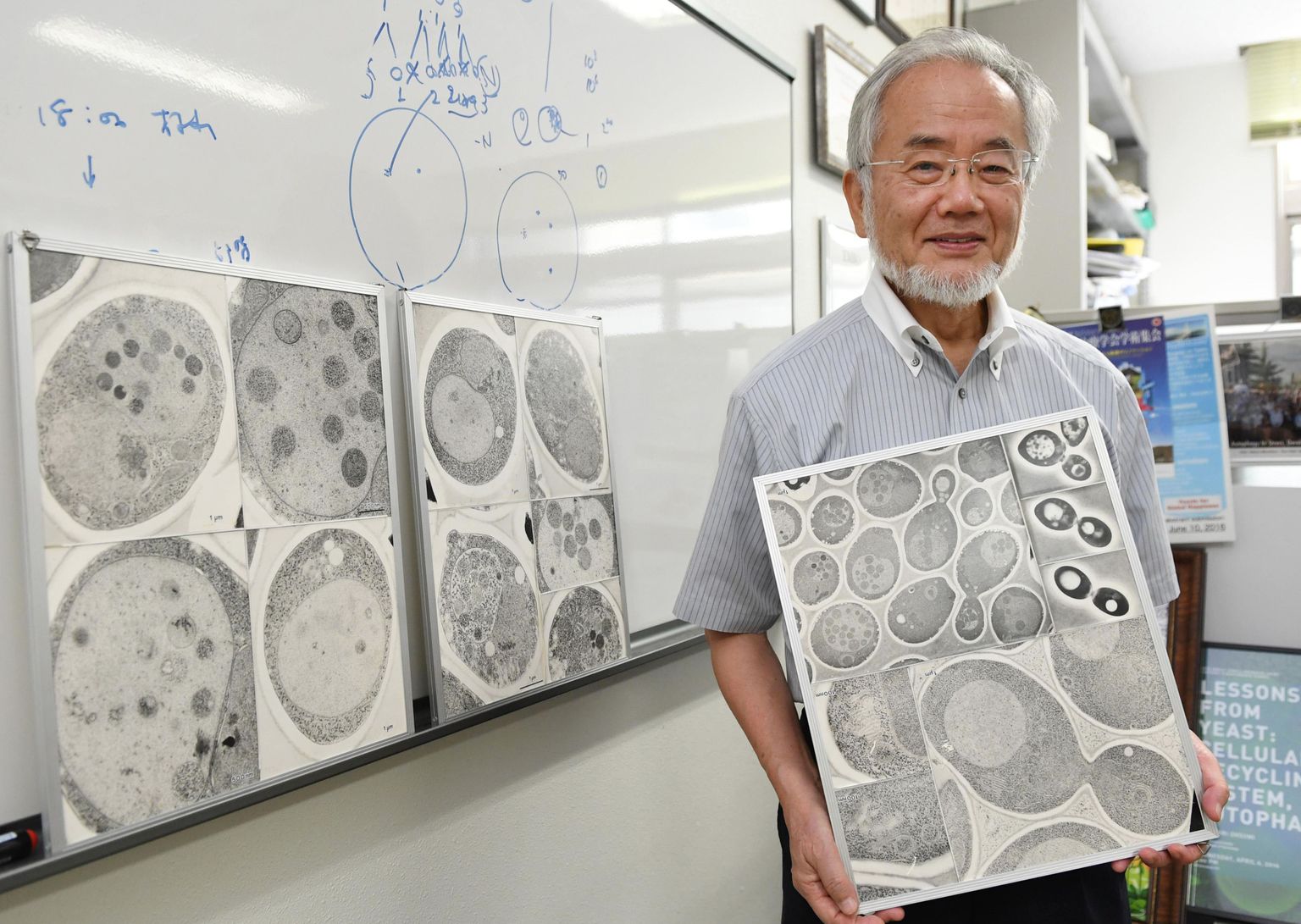 Lisaks Nobeli preemiale pärjati Jaapano teadlane Yoshinori Ohsumi tänavu ka läbimurde auhinnaga. Ohsumile anti Nobel rakkudes toimuva autofaagia protsessi avastamise ja kirjeldamise eest.