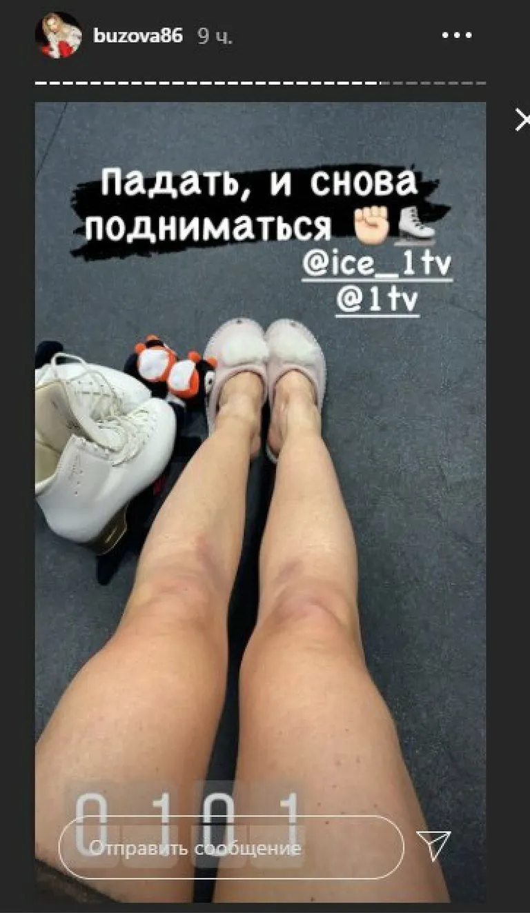Певица показала ноги в синяках