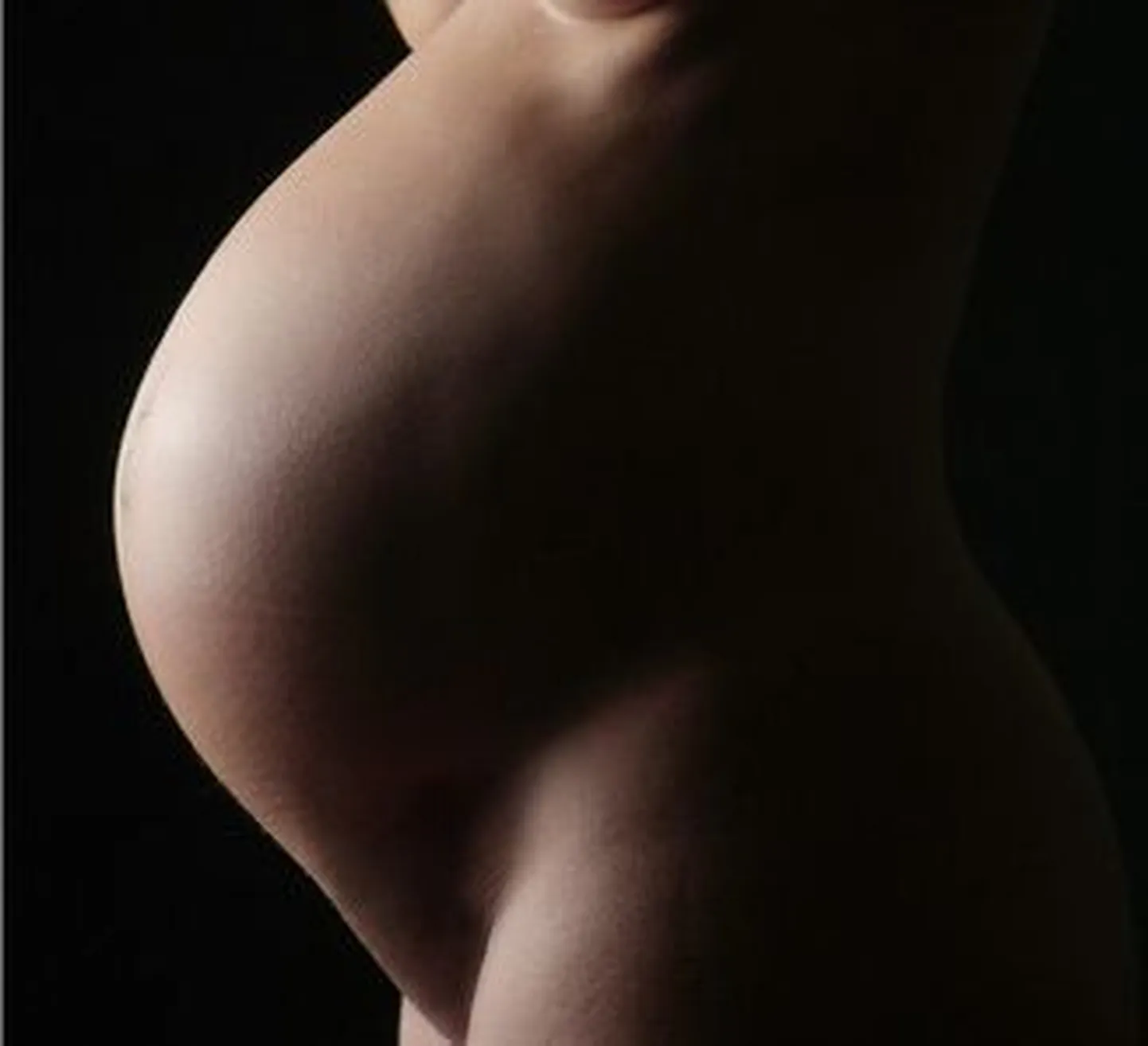 Arstid on ülekaalulise naise rasedusest hämmingus