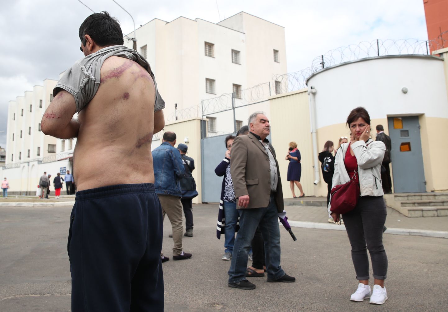 Minskis meeleavalduste ajal vahistatud Vardan Grigrjan tõstab vabadusse pääsemise järel üles oma särgi ning näitab jälgi peksmisest.