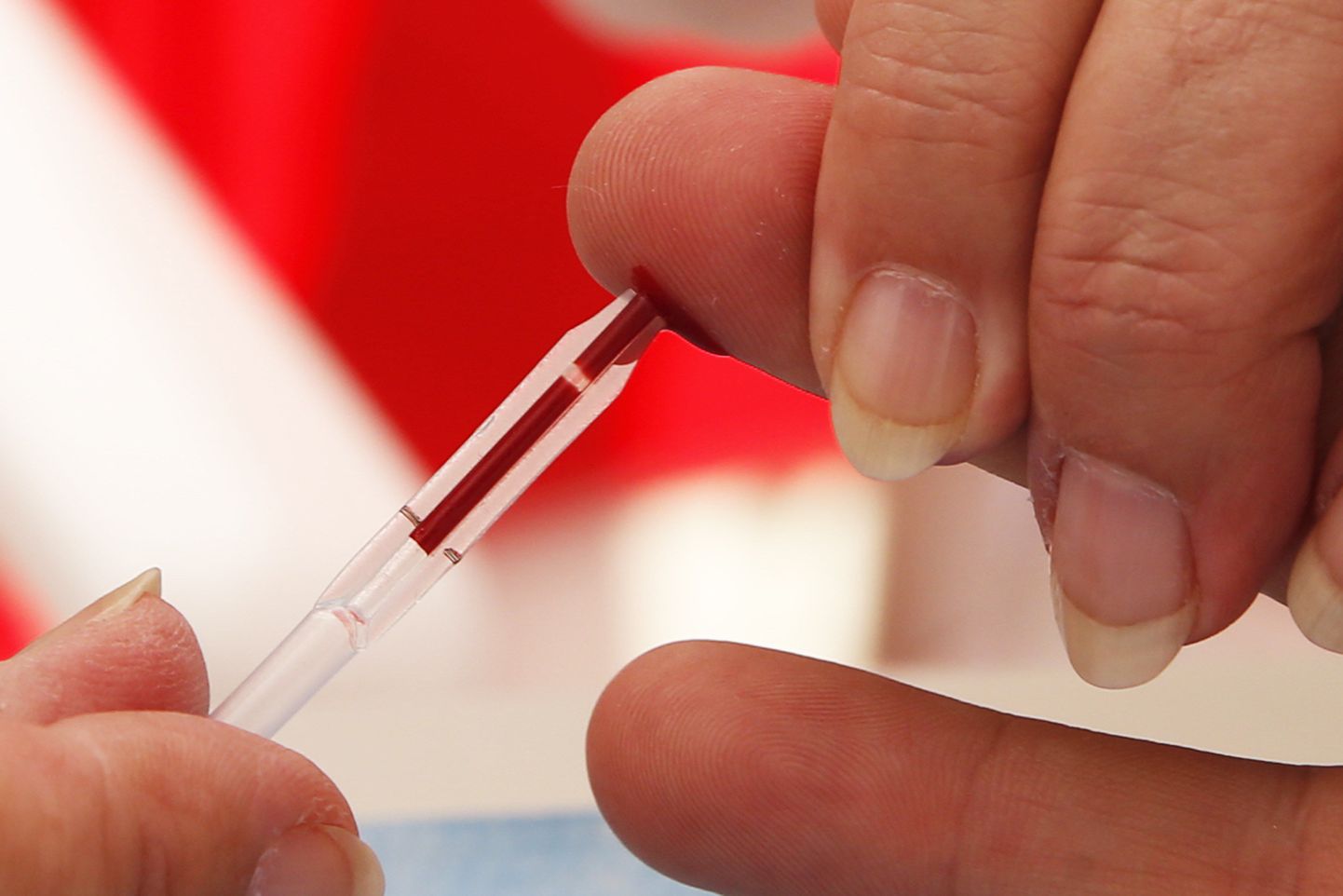 HIV-i vaktsiini pole veel leiutatud, ent ekspertide sõnul on antikehad üks võimalustest.