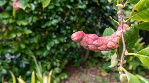 Уролог-сексолог: какой половой член нормальный?