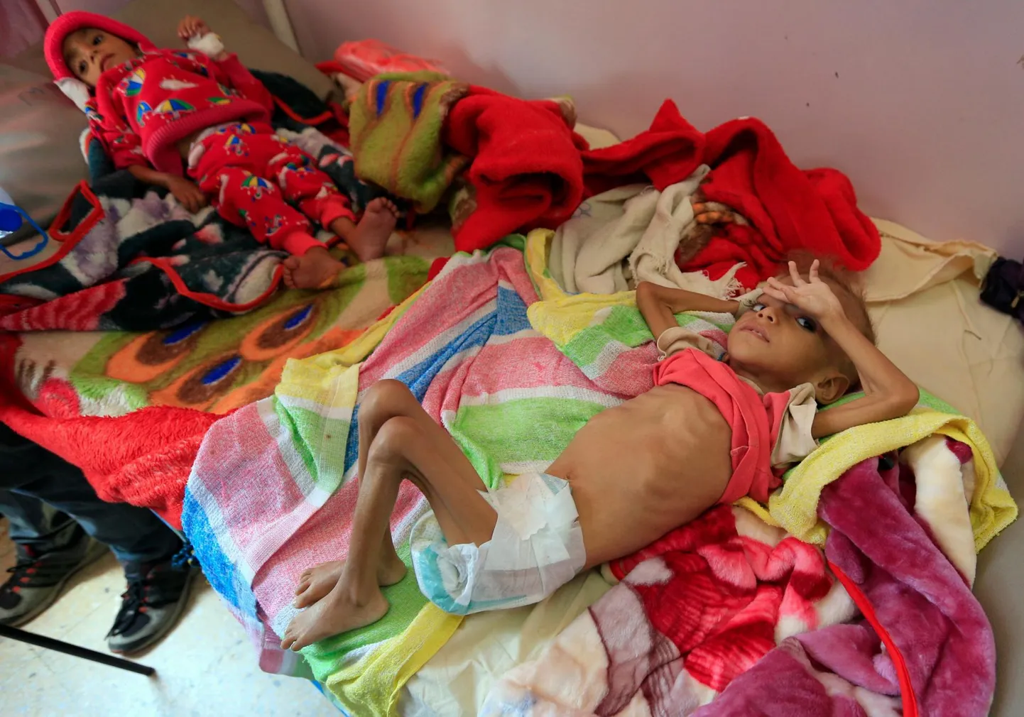 Rängas alatoitumuses Jeemeni lapsed pealinna Sanaa haiglas oktoobri alguses.
