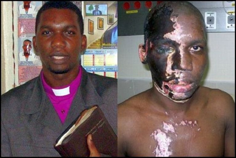 Uganda pastor Umar Mulinde enne ja pärast happerünnakut.