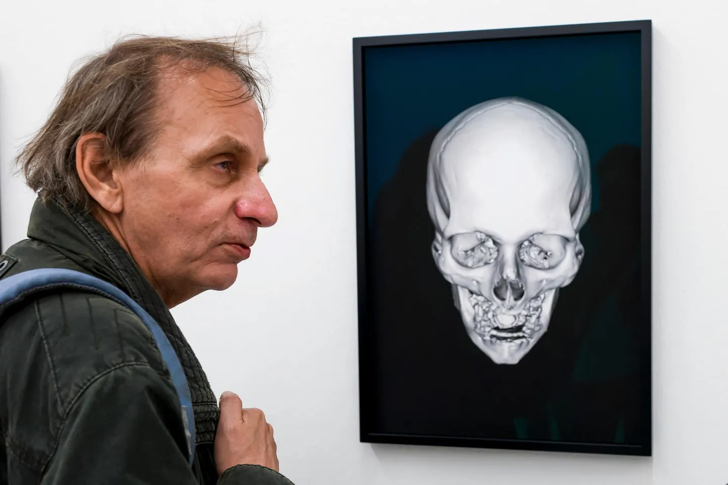 Michel Houellebecq vaatab 2016. aastal Zürichis näitusel Manifesta röntgenipilti oma peast.