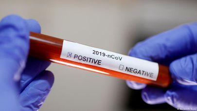 Положительный тест на коронавирус