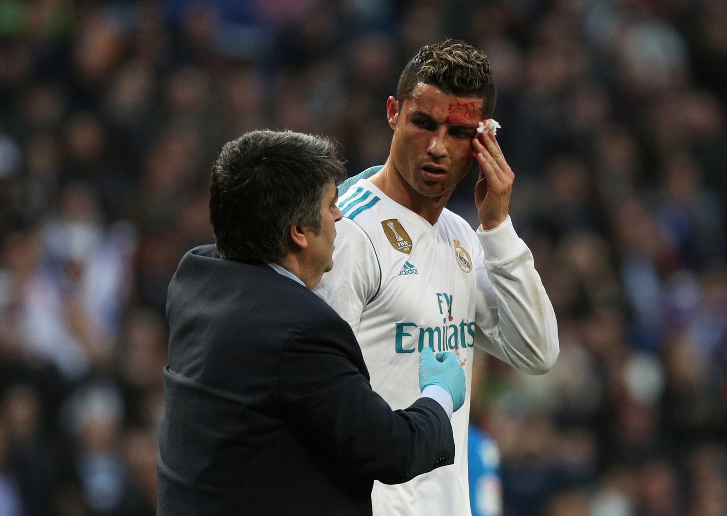 Cristiano Ronaldol löödi väravaolukorras nägu veriseks.